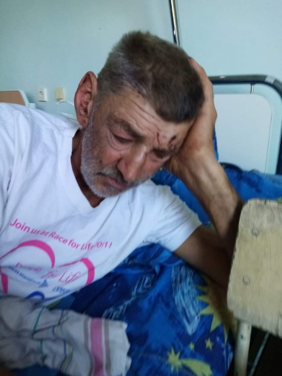 На Сумщині розшукують чоловіка, який залишив лікарню з тяжкою травмою голови